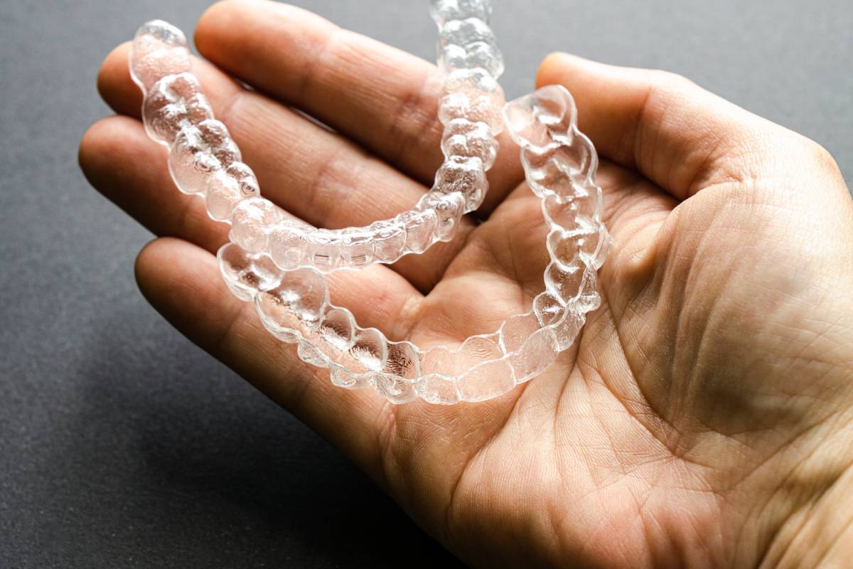 Featured image for Can Invisalign Cause Gum Recession